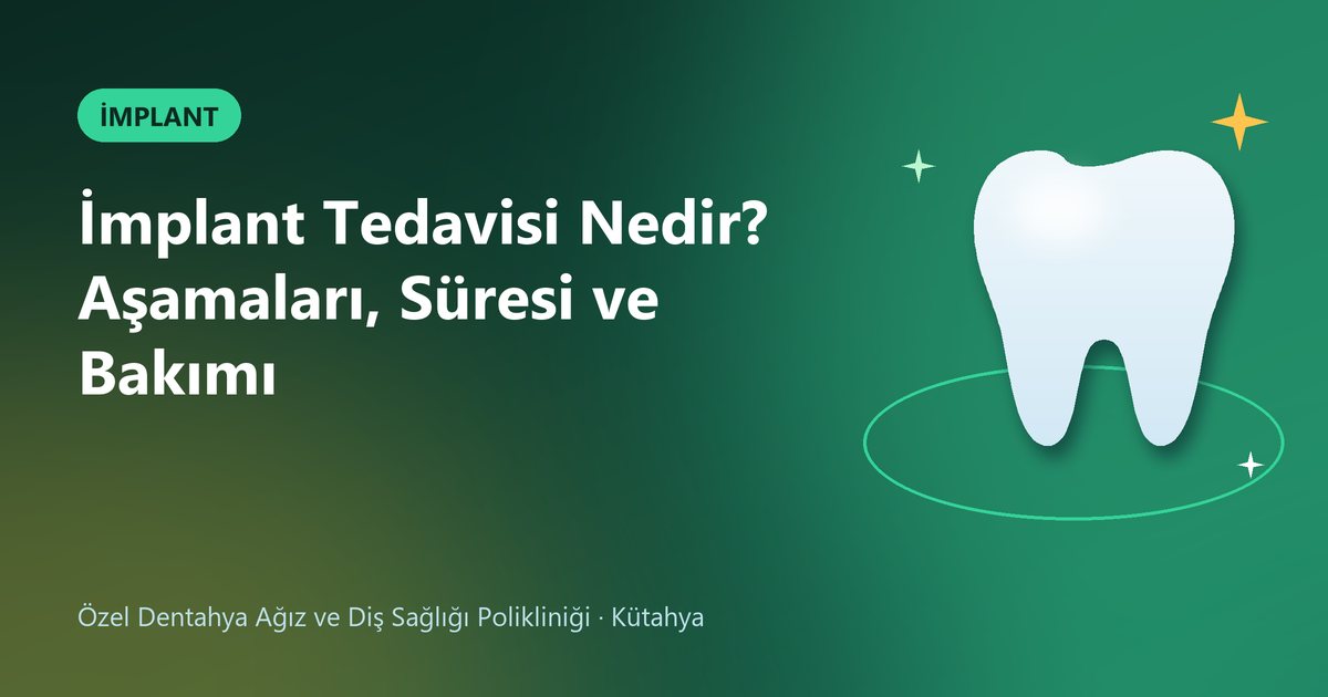 İmplant Tedavisi Nedir? Aşamaları, Süresi ve Bakımı – Dentahya Diş blog kapak görseli
