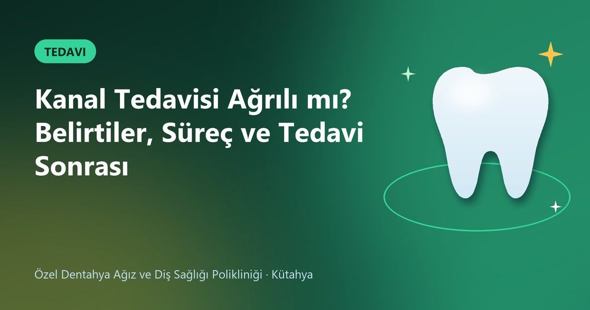 Kanal Tedavisi Ağrılı mı? Belirtiler, Süreç ve Tedavi Sonrası – Dentahya Diş blog kapak görseli